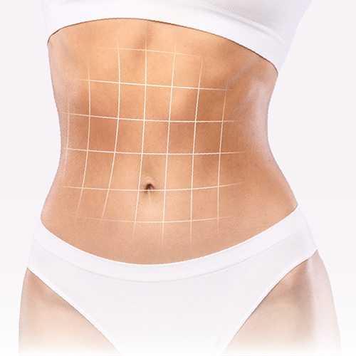 Tummy Tuck Turkey Abdominoplasty