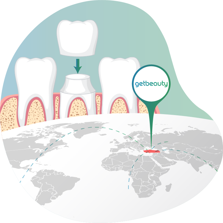 Zirconium crowns abroad