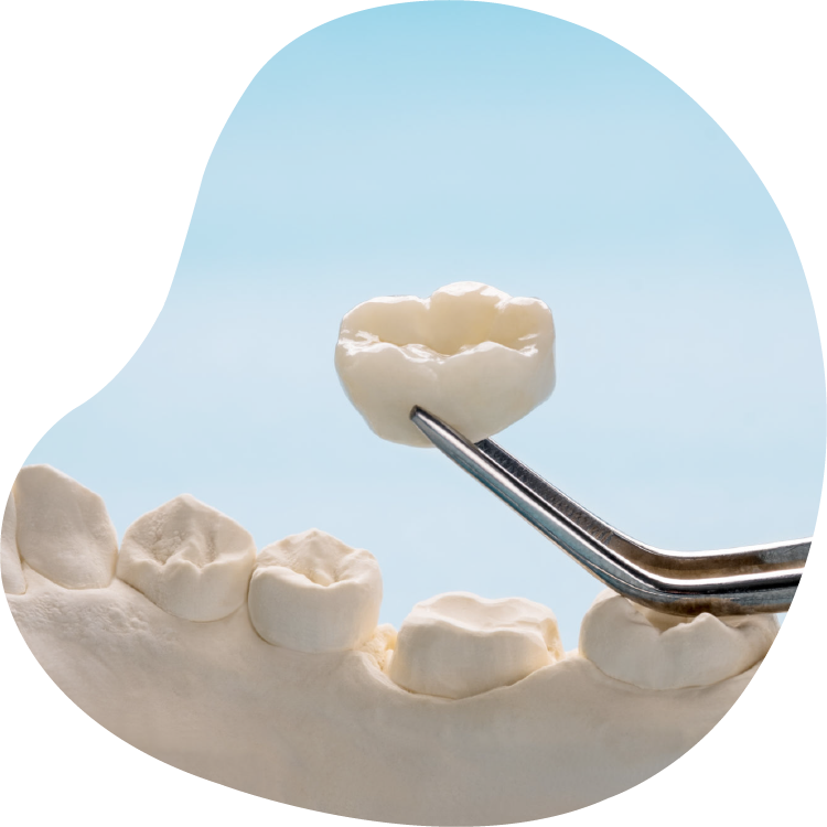 Zirconium Crowns