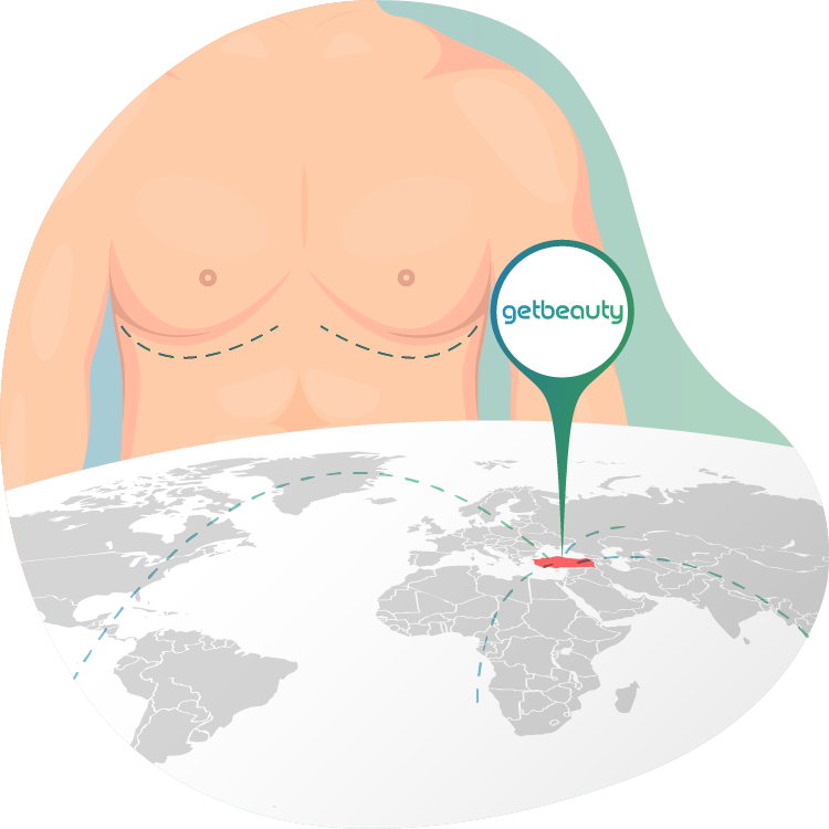 Gynecomastia Abroad
