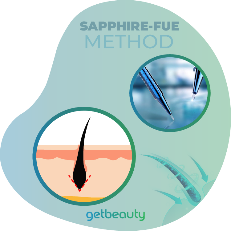 Hair Transplant Sapphire FUE Method