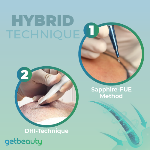 Hair Transplant Turkey Hybrid Technique