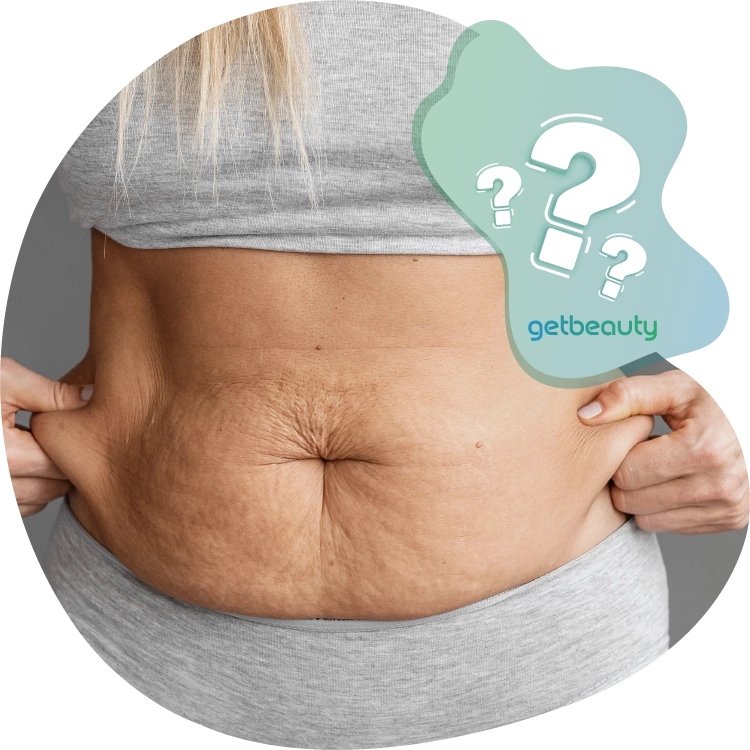 What are the risks with a tummy tuck
